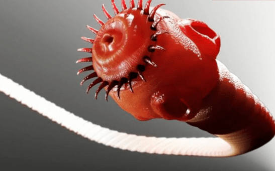 A worm parasite from the human body