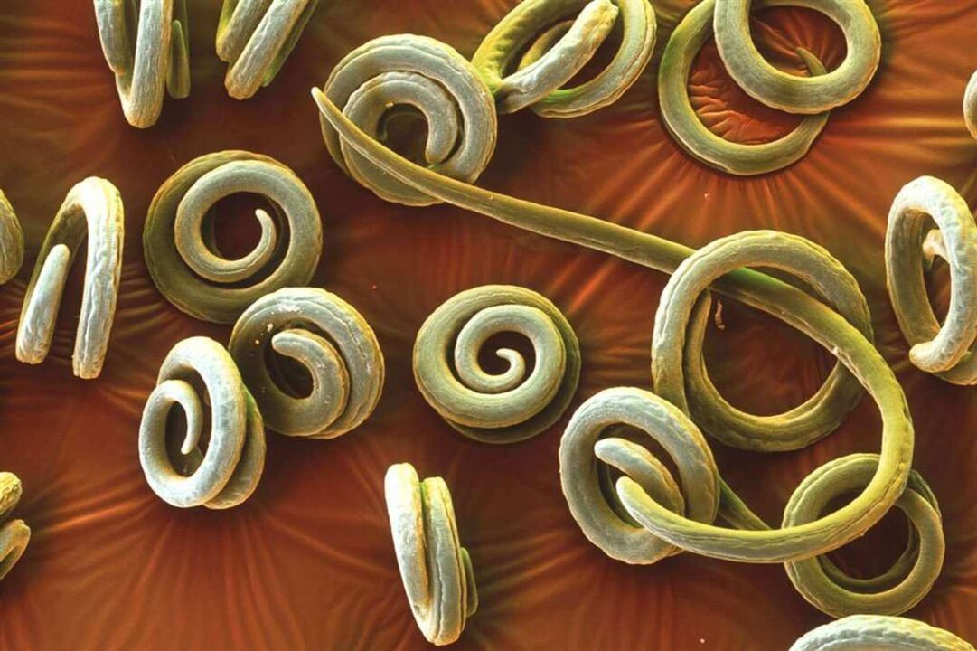 Worms are parasites from the human body