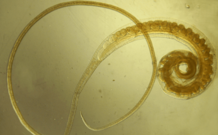 Human worm - a helminth that affects adults