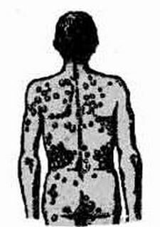 A possible infection scheme