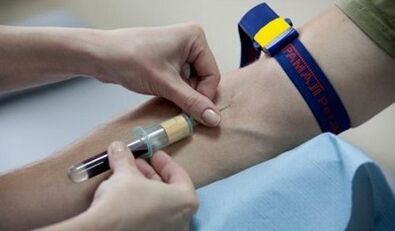 How to prepare for a parasite test