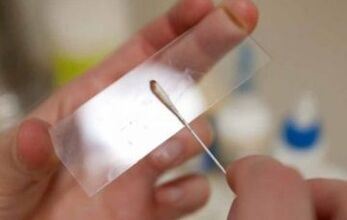 What tests should be performed for parasites