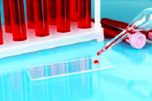 A blood test
