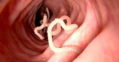 The causes of parasites in the human body