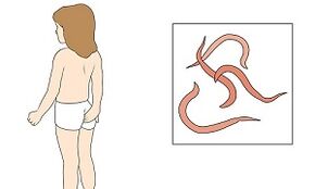 Symptoms of the presence of parasites in the human body