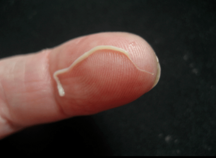A roundworm parasite from the human body