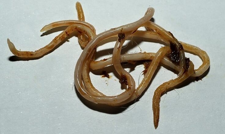 Toxocara from the human body